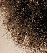 DIAGNOSIS HAIR